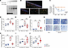 Pharmacological inhibition of miR-33 using PNA-33 in lung macrophages prote