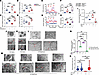 The absence of miR-33 in macrophages improves mitochondrial homeostasis (fu