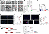 The absence of miR-33 in lung macrophages improves mitochondrial homeostasi