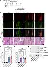 In vivo electroporation triggers AQP4 overexpression in skeletal muscle.