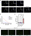 AQP4 immunization generates AQP4 autoantibodies.