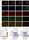 IgG infiltration and astrocytopathy after AQP4 immunization.