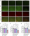 Oligodendrocyte loss, demyelination, and axonal loss after AQP4 immunizatio