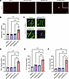 Microglia activation and increase in proinflammatory cytokine levels after