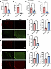 AQP4 immunization does not induce motor impairments and spinal cord patholo