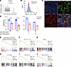 PD-1 signaling inhibited proliferation of malignant T cells.