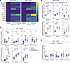 Short-course ATRi treatment potentiates RT-induced inflammatory cytokines a