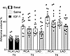 IGF-1 reduces coronary atheroma volume.