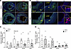 IGF-1 suppresses MF-like cells and upregulates EC-like cells in coronary pl