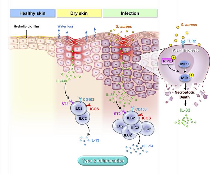 graphical abstract