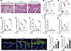 S. aureus infection exacerbates delipidization-induced IL-33 expression and