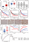 High-level expression of SETD1A is associated with poor outcome in patients