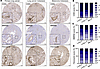 CD93, MMRN2, and fibronectin are highly expressed in the blood vessels of p