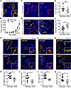 CD93 deficiency impairs subcutaneous HCmel12 melanoma growth and tumor vasc