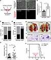 Deletion of CD93 increases endothelial transmigration of tumor cells and pr