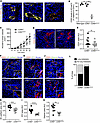 Endothelial cell–specific CD93 deletion impairs HCmel12 vascular integrity