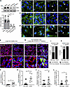 CD93 knockdown impairs endothelial junctions in murine lung endothelial cel