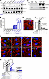 CD93 interacts with VEGFR2 and attenuates its phosphorylation in response t