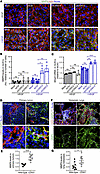 CD93 regulates MMP9 levels in vitro as well as in primary and metastatic si