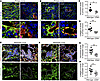 CD93 deficiency impairs extracellular matrix deposition in the primary tumo