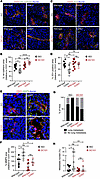 VEGFR2 inhibition restores tumor vessel integrity in CD93-deficient mice an