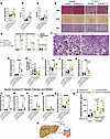 Intestinal FGF15 is not necessary to suppress steatosis and fibrosis in the