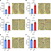 Amygdala and hippocampal volume are significantly altered in infected mice.