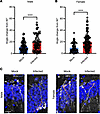 Newborn neuron growth is altered in infected mice.