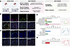 Immunogenotyping of primary and recurrent archival GBM samples.