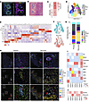 Spatial profiling of perivascular regions in primary and recurrent GBM.