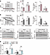 Exercise suppression of ANGPTL3 tissue binding increases LPL activity in th