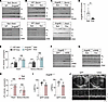 ANGPTL8 mediates exercise suppression of ANGPTL3 tissue binding in the post