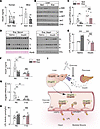 Postprandial exercise suppresses hepatic Angptl8 expression via reduction o