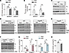 Postprandial exercise suppresses white adipose tissue LPL activity independ