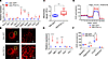 PGC1α increase mitochondrial biogenesis, mitochondrial fusion, and mitochon