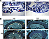 Osteoprotogerin eliminates endosteal bone formation in adult mice.