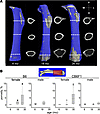 Femoral cortical porosity increases with age in females, but not males, in