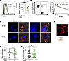 In vitro treatment with 2DG decreases NK cell production of granzyme B and