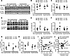 Acetylation control of fatty acid β-oxidation enzymes in neonatal human hea