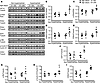 Upregulation of HIF1α and pyruvate dehydrogenase kinase in hypertrophied hu