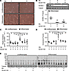 Expression of general control of amino acid synthesis 5-like protein 1, ove