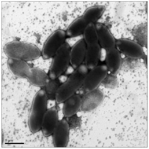 Transmission Electron Microscopy (TEM) of exponential phase culture of CoronadoT in lysogeny broth (LB), grown at 23 °C.