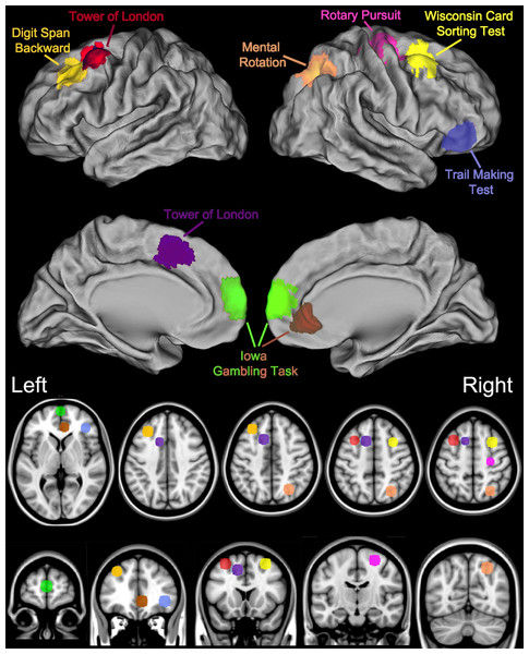 Key brain areas as identified by neuroimaging and lesion studies and the corresponding Psychology Experiment Building Language Tests.