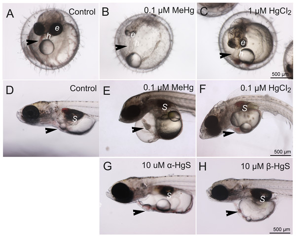 Control morphology and common phenotypic alterations in embryos and larvae following exposure to mercury compounds: embryos at 5 dpf: (A) control; (B) 0.1 µM MeHg; and (C) 1 µM HgCl2.