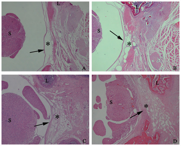 The effect of HCPT on epidural fibrosis in rats.