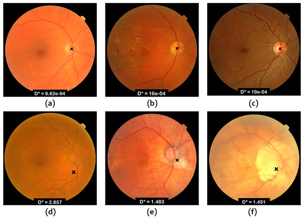 OD localization in images from Messidor database.