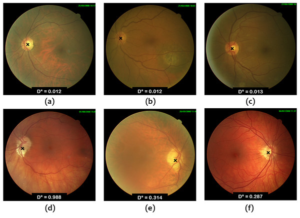 OD localization in images from ONHSD database.