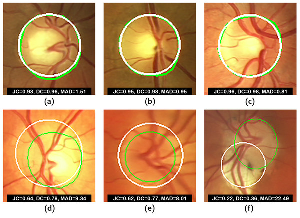 Images from ONHSD database.