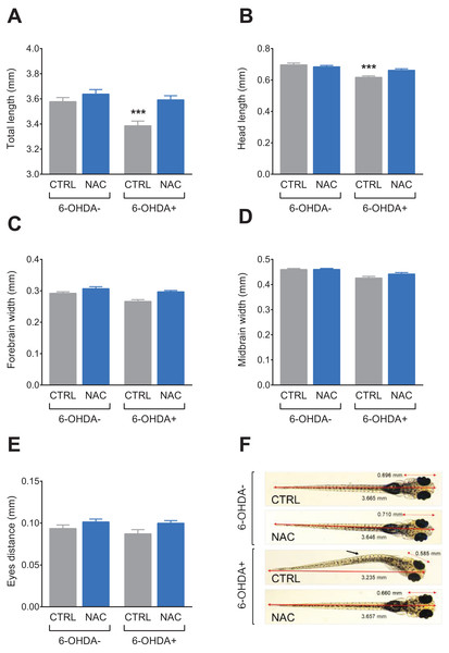 Effects of NAC on 6-OHDA-induced morphological alterations in larvae zebrafish.