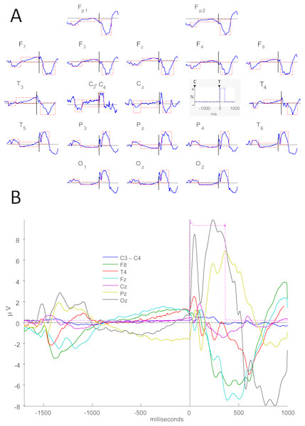 Electrical potentials related to Attention Network Test.